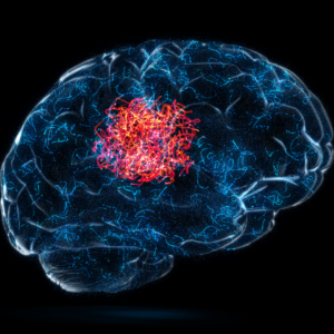 Early Detection of Alzheimer's Disease